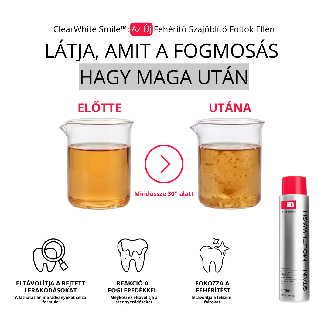 ClearWhite Smile™: Az Új Fehérítő Szájöblítő Foltok Ellen