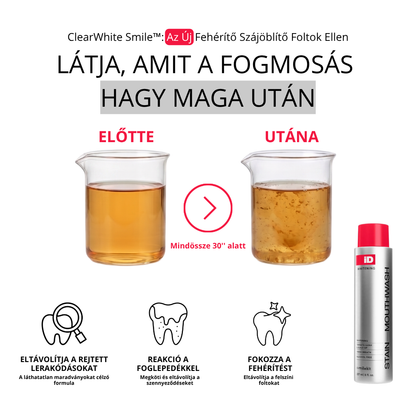 ClearWhite Smile™: Az Új Fehérítő Szájöblítő Foltok Ellen